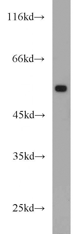 HeLa cells were subjected to SDS PAGE followed by western blot with Catalog No:117300(tubulin-Alpha antibody) at dilution of 1:1000