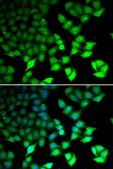 Immunofluorescence - KDM4B Polyclonal Antibody 