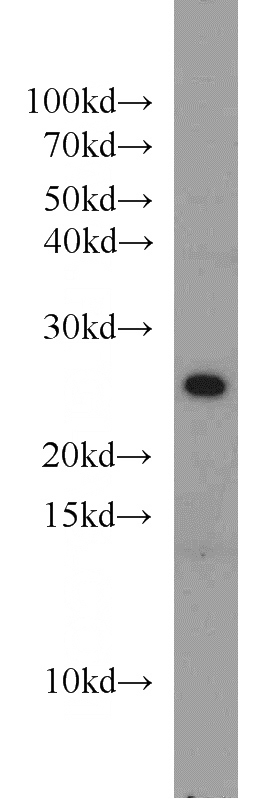 mouse liver tissue were subjected to SDS PAGE followed by western blot with Catalog No:115680(STARD5 antibody) at dilution of 1:500