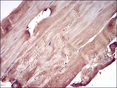 Immunohistochemical analysis of paraffin-embedded muscle tissues using PRL mouse mAb with DAB staining.
