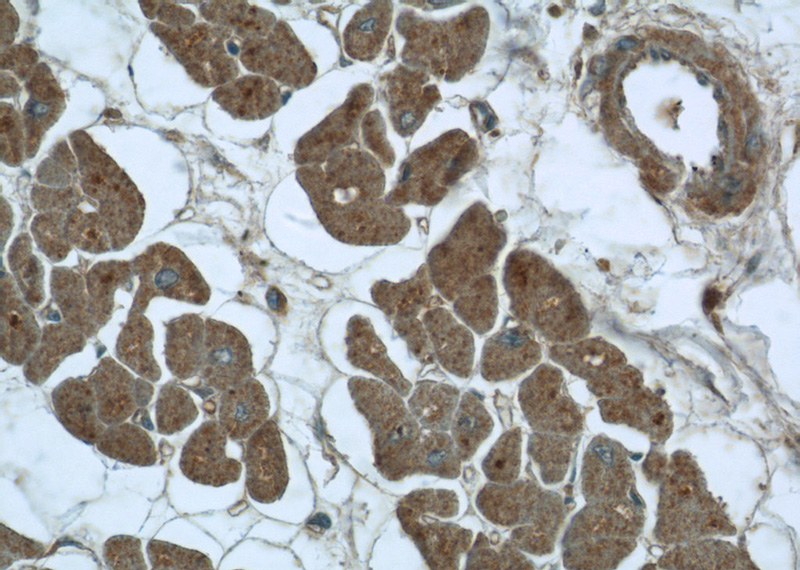 Immunohistochemistry of paraffin-embedded human heart tissue slide using Catalog No:109841(DDX58 Antibody) at dilution of 1:50 (under 40x lens)