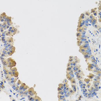Immunohistochemistry - IL25 Polyclonal Antibody 