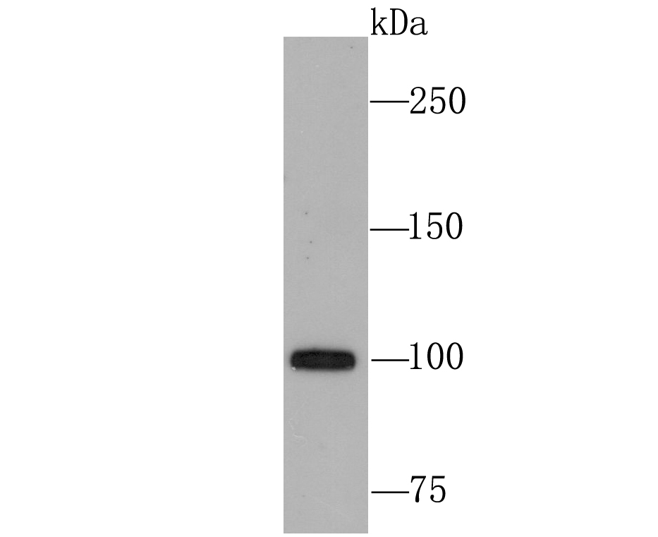 Fig1:; Western blot analysis of USP11 on 293T cell lysates. Proteins were transferred to a PVDF membrane and blocked with 5% BSA in PBS for 1 hour at room temperature. The primary antibody ( 1/500) was used in 5% BSA at room temperature for 2 hours. Goat Anti-Rabbit IgG - HRP Secondary Antibody (HA1001) at 1:200,000 dilution was used for 1 hour at room temperature.