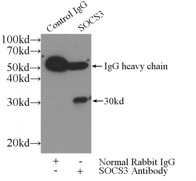 IP Result of anti-SocS3 (IP:Catalog No:115489, 4ug; Detection:Catalog No:115489 1:500) with K-562 cells lysate 1720ug.