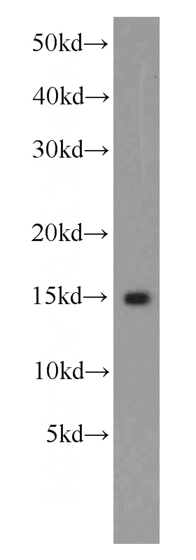 human brain tissue were subjected to SDS PAGE followed by western blot with Catalog No:111937(ISG15 antibody) at dilution of 1:500