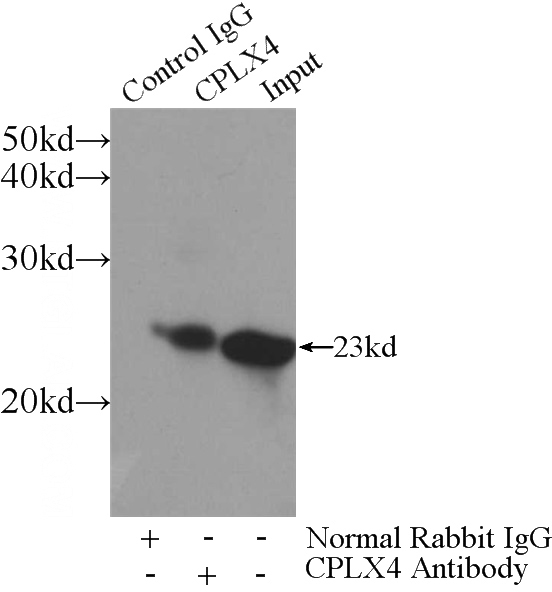 IP Result of anti-CPLX4 (IP:Catalog No:109513, 3ug; Detection:Catalog No:109513 1:1000) with Y79 cells lysate 960ug.