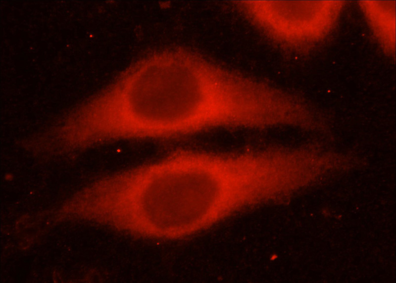 Immunofluorescent analysis of MCF-7 cells using Catalog No:116056(TSP1 Antibody) at dilution of 1:50 and Rhodamine-Goat anti-Rabbit IgG