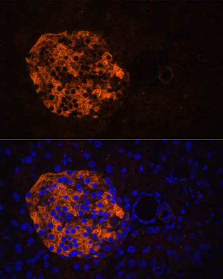 Immunofluorescence - PNLIPRP2 Polyclonal Antibody 