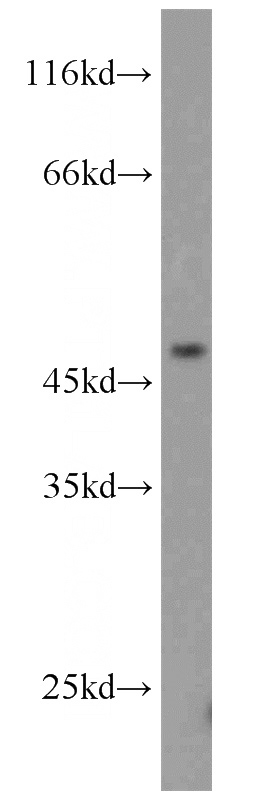 L02 cells were subjected to SDS PAGE followed by western blot with Catalog No:116298(TRIM14 antibody) at dilution of 1:1000