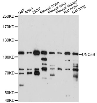 Western blot - UNC5B Polyclonal Antibody 