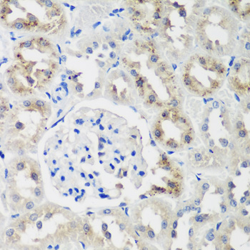 Immunohistochemistry - NEDD4L Polyclonal Antibody 