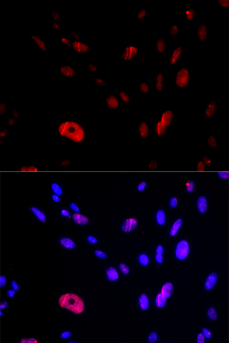 Immunofluorescence - HUS1 Polyclonal Antibody 