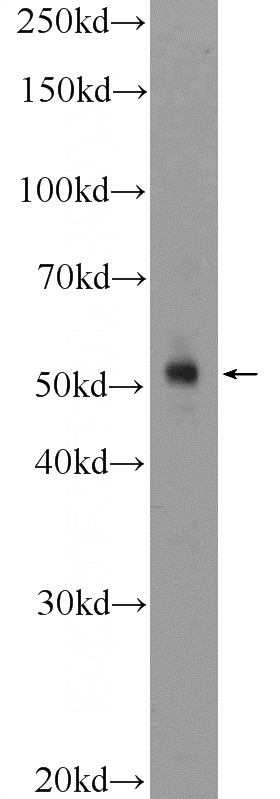 K-562 cells were subjected to SDS PAGE followed by western blot with Catalog No:109665(Cyclin E Antibody) at dilution of 1:600