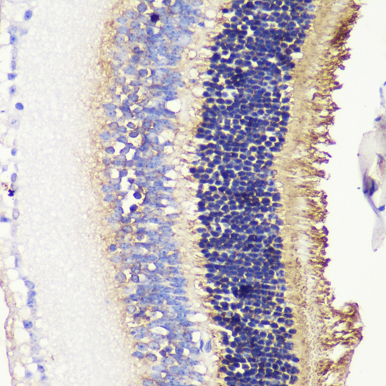 Immunohistochemistry - PDC Polyclonal Antibody 