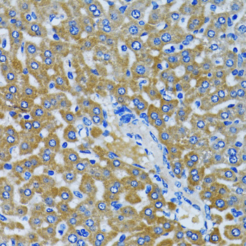 Immunohistochemistry - HDAC5 Polyclonal Antibody 