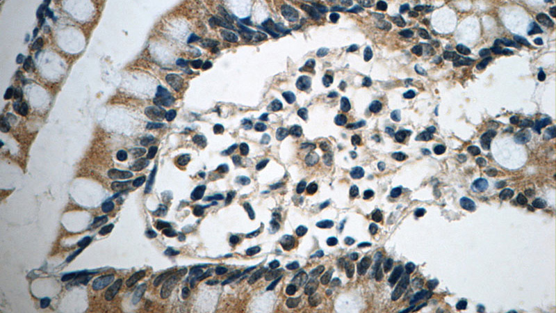 Immunohistochemistry of paraffin-embedded human small intestine tissue slide using Catalog No:114433(RAB34 Antibody) at dilution of 1:50 (under 40x lens)