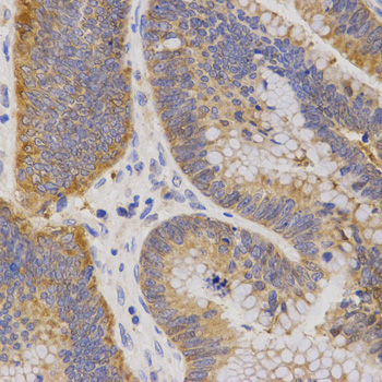 Immunohistochemistry - P2RY11 Polyclonal Antibody 