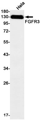 Western blot detection of FGFR3 in Hela cell lysates using FGFR3 Rabbit mAb(1:1000 diluted).Predicted band size:88kDa.Observed band size:88kDa.