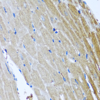 Immunohistochemistry - DFNA5 Polyclonal Antibody 