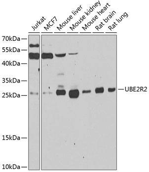 Western blot - UBE2R2 Polyclonal Antibody 