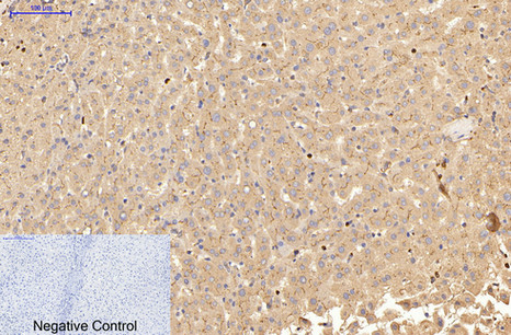 Immunohistochemical analysis of paraffin-embedded Human-liver tissue. 1,Carcinoembryonic Antigen Monoclonal Antibody(10E1) was diluted at 1:200(4°C,overnight). 2, Sodium citrate pH 6.0 was used for antibody retrieval(>98°C,20min). 3,Secondary antibody was diluted at 1:200(room tempeRature, 30min). Negative control was used by secondary antibody only.