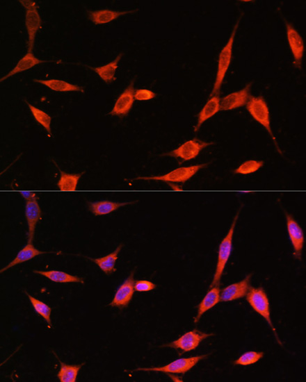 Immunofluorescence - PIK3R3 Polyclonal Antibody 
