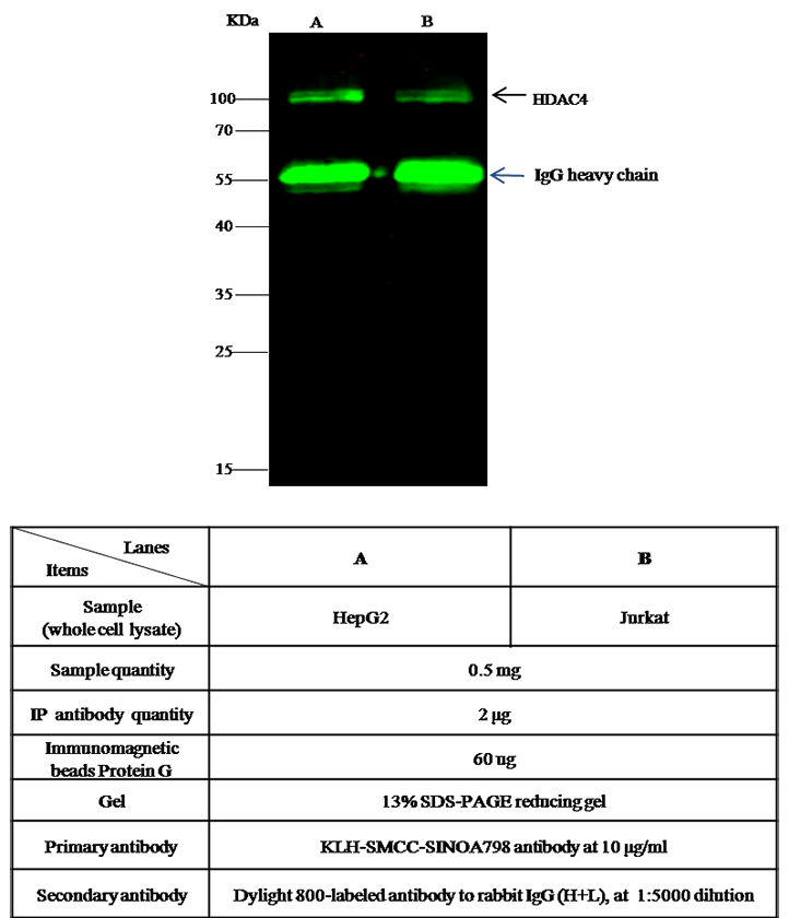 HDAC4 Antibody, Rabbit PAb, Antigen Affinity Purified, Immunoprecipitation