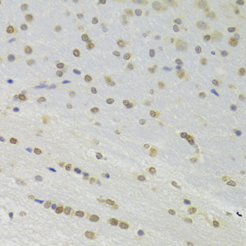 Immunohistochemistry - DOK1 Polyclonal Antibody 