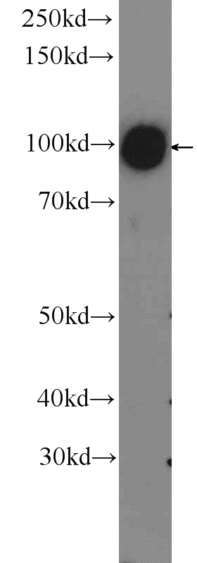 mouse liver tissue were subjected to SDS PAGE followed by western blot with Catalog No:107964(ALDH1L1 Antibody) at dilution of 1:300