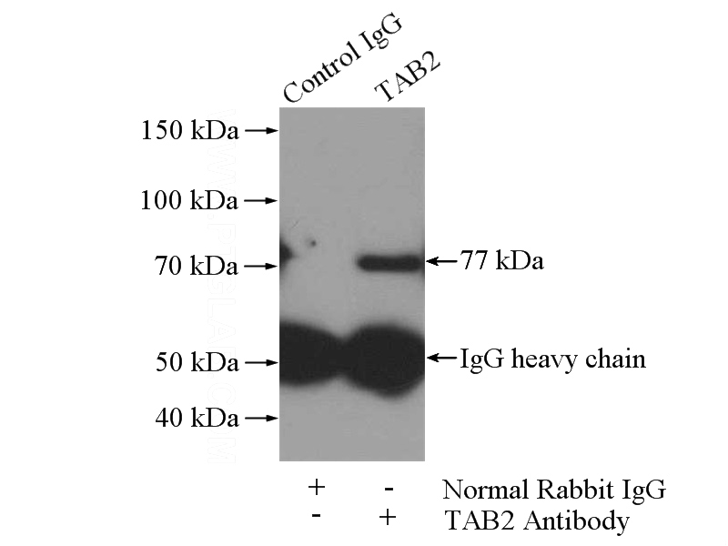 IP Result of anti-MAP3K7IP2 (IP:Catalog No:115965, 4ug; Detection:Catalog No:115965 1:600) with HepG2 cells lysate 3600ug.