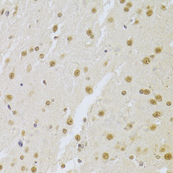 Immunohistochemistry - SNRPA Polyclonal Antibody 