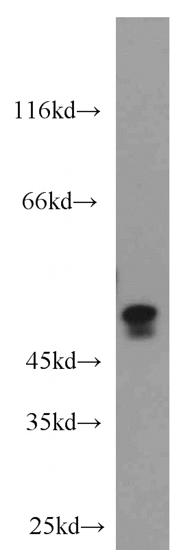 mouse kidney tissue were subjected to SDS PAGE followed by western blot with Catalog No:108873(CASP2 antibody) at dilution of 1:500