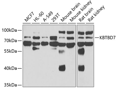 Western blot - KBTBD7 Polyclonal Antibody 