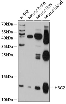 Western blot - HBG2 Polyclonal Antibody 