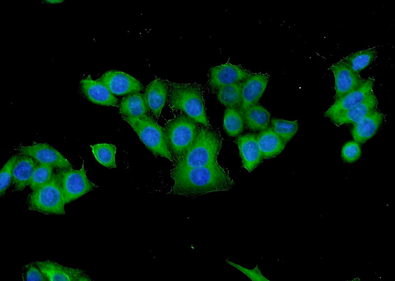 Immunofluorescent analysis of HeLa cells using Catalog No:108415(BAK Antibody) at dilution of 1:50 and Alexa Fluor 488-congugated AffiniPure Goat Anti-Rabbit IgG(H+L)