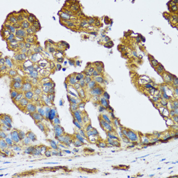 Immunohistochemistry - SLC25A13 Polyclonal Antibody 