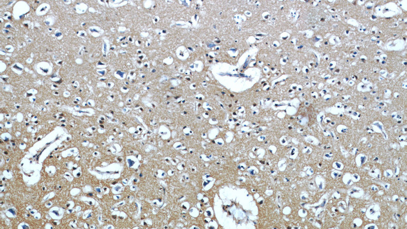 Immunohistochemical of paraffin-embedded human brain using Catalog No:111785(IMPDH2 antibody) at dilution of 1:50 (under 10x lens)