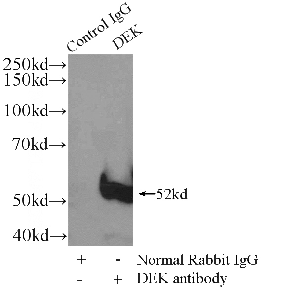 IP Result of anti-DEK (IP:Catalog No:109886, 4ug; Detection:Catalog No:109886 1:500) with HeLa cells lysate 1200ug.