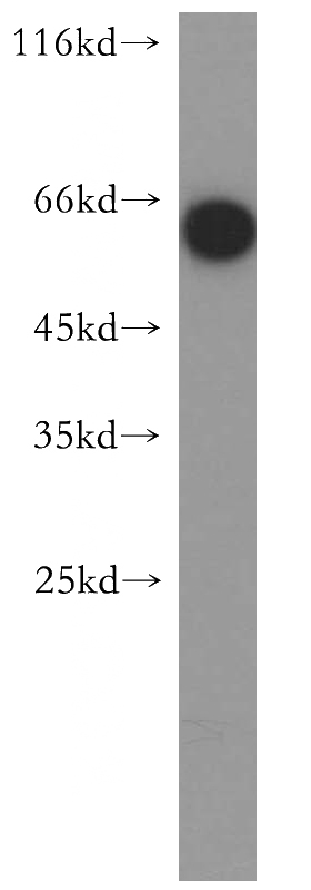 human brain tissue were subjected to SDS PAGE followed by western blot with Catalog No:110332(ENTPD3 antibody) at dilution of 1:500