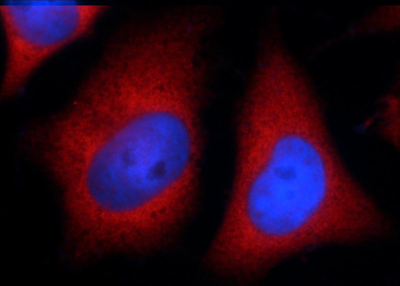 Immunofluorescent analysis of HeLa cells using Catalog No:109650(CXorf26 Antibody) at dilution of 1:50 and Rhodamine-Goat anti-Rabbit IgG