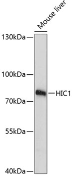 Western blot - HIC1 Polyclonal Antibody 