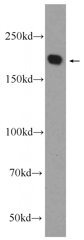 HeLa cells were subjected to SDS PAGE followed by western blot with Catalog No:113377(NUP205 Antibody) at dilution of 1:2000