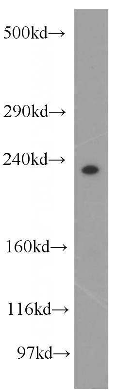 HeLa cells were subjected to SDS PAGE followed by western blot with Catalog No:113746(PCNXL2 antibody) at dilution of 1:500