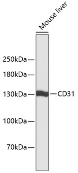 Western blot - CD31 Polyclonal Antibody 