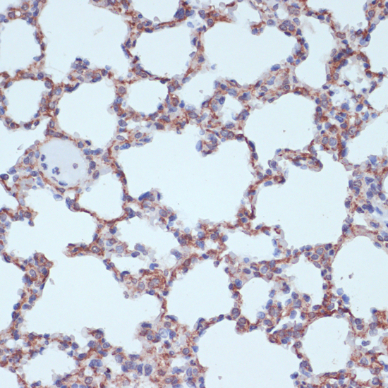 Immunohistochemistry - TPD52 Polyclonal Antibody 