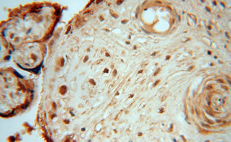 Immunohistochemical of paraffin-embedded human placenta using Catalog No:109880(DBR1 antibody) at dilution of 1:100 (under 40x lens)