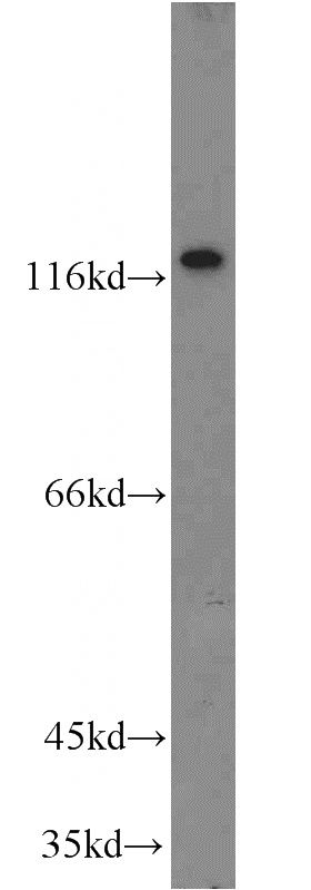 mouse brain tissue were subjected to SDS PAGE followed by western blot with Catalog No:114569(CDH4 antibody) at dilution of 1:300