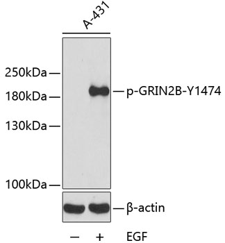 Western blot - Phospho-GRIN2B-Y1474 pAb 