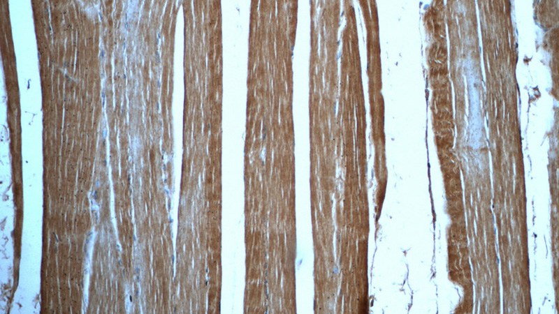 Immunohistochemistry of paraffin-embedded human skeletal muscle tissue slide using Catalog No:112993(MYOM1-Specific Antibody) at dilution of 1:50 (under 10x lens)