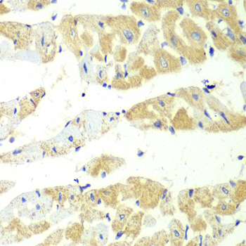 Immunohistochemistry - TBXAS1 Polyclonal Antibody 